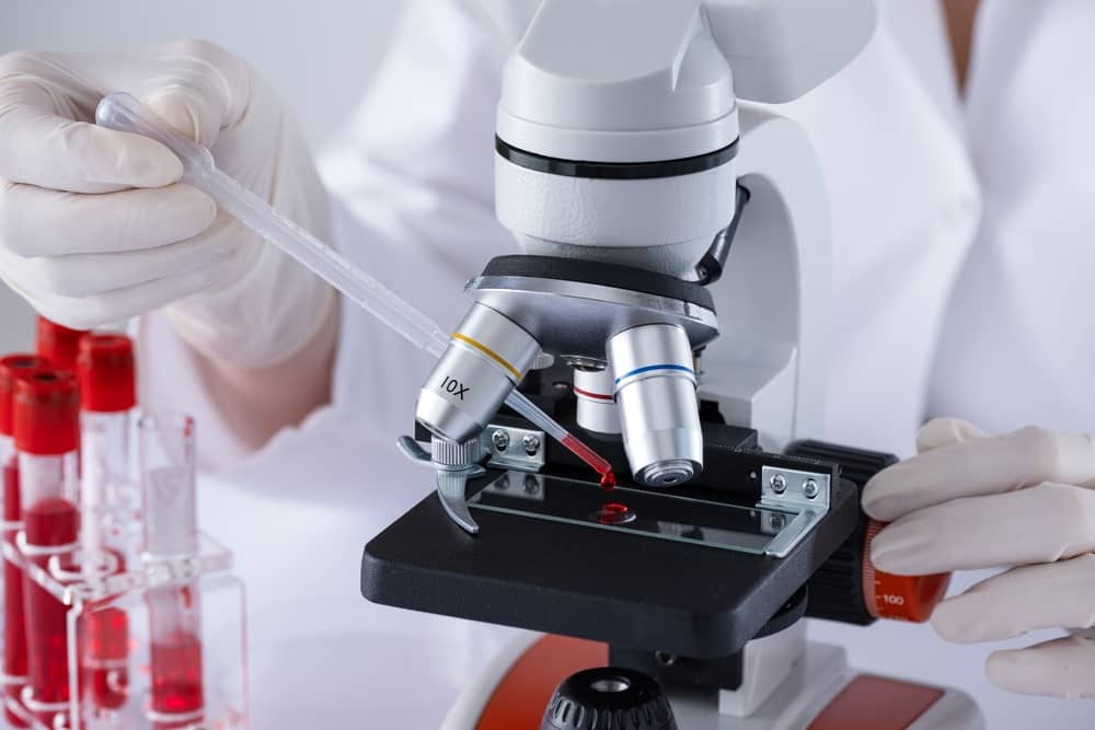 Laboratory scientist examining platelet rich plasma sample under microscope for PRP hair loss treatment quality analysis