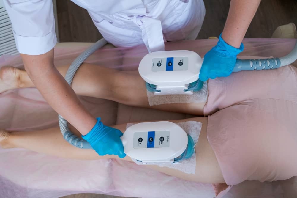 Professional fat freezing treatment showing dual cryolipolysis applicators on patient's thighs for non-invasive fat reduction and body contouring